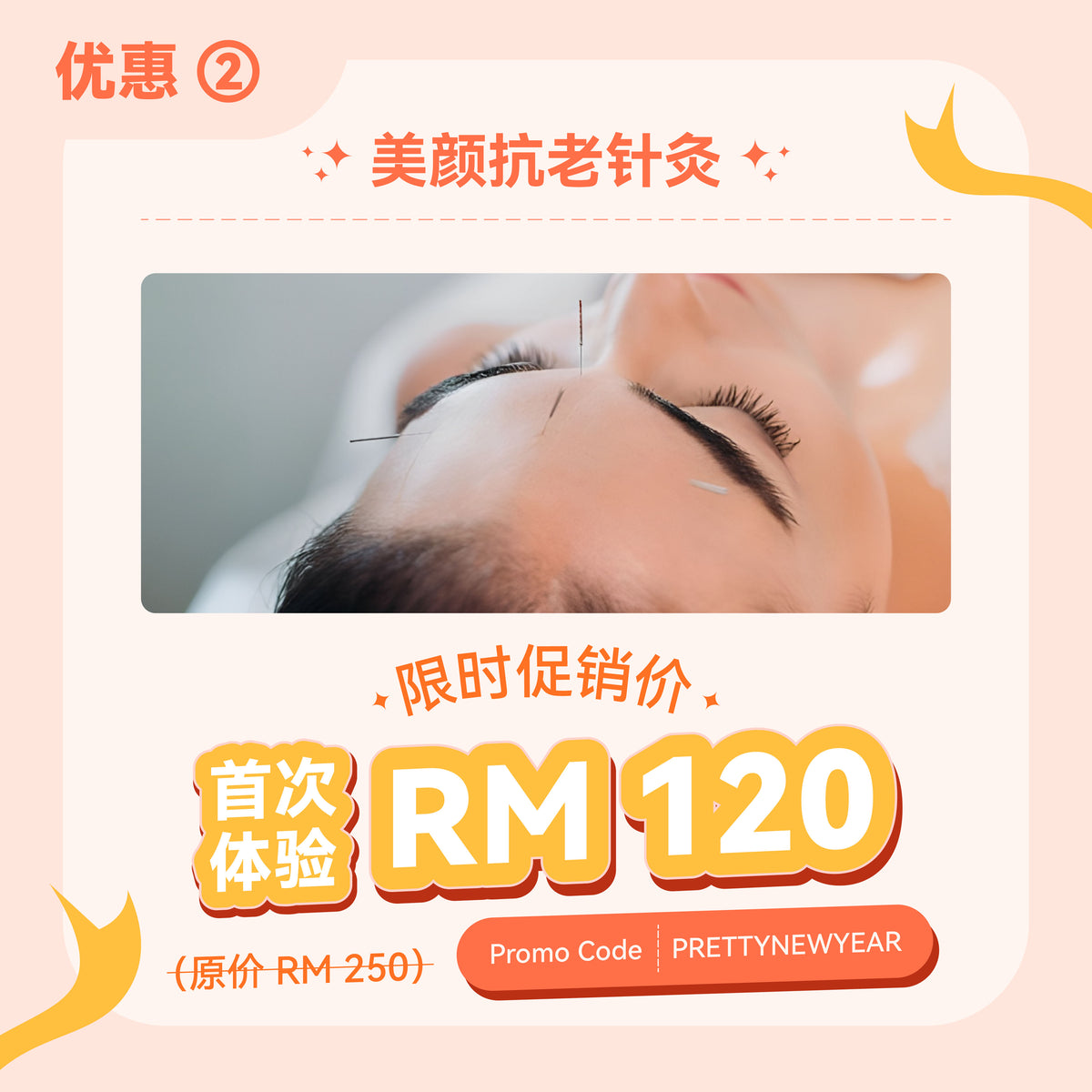 中医美颜抗老针首次体验