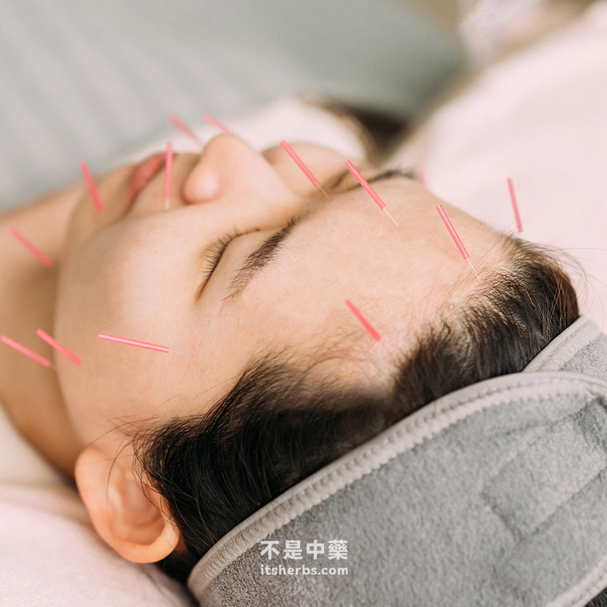 中医美颜抗老针首次体验