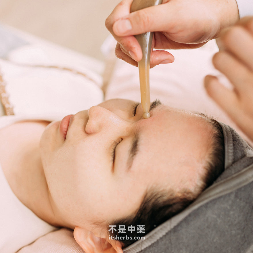 Beauty and Anti-aging Acupuncture Package