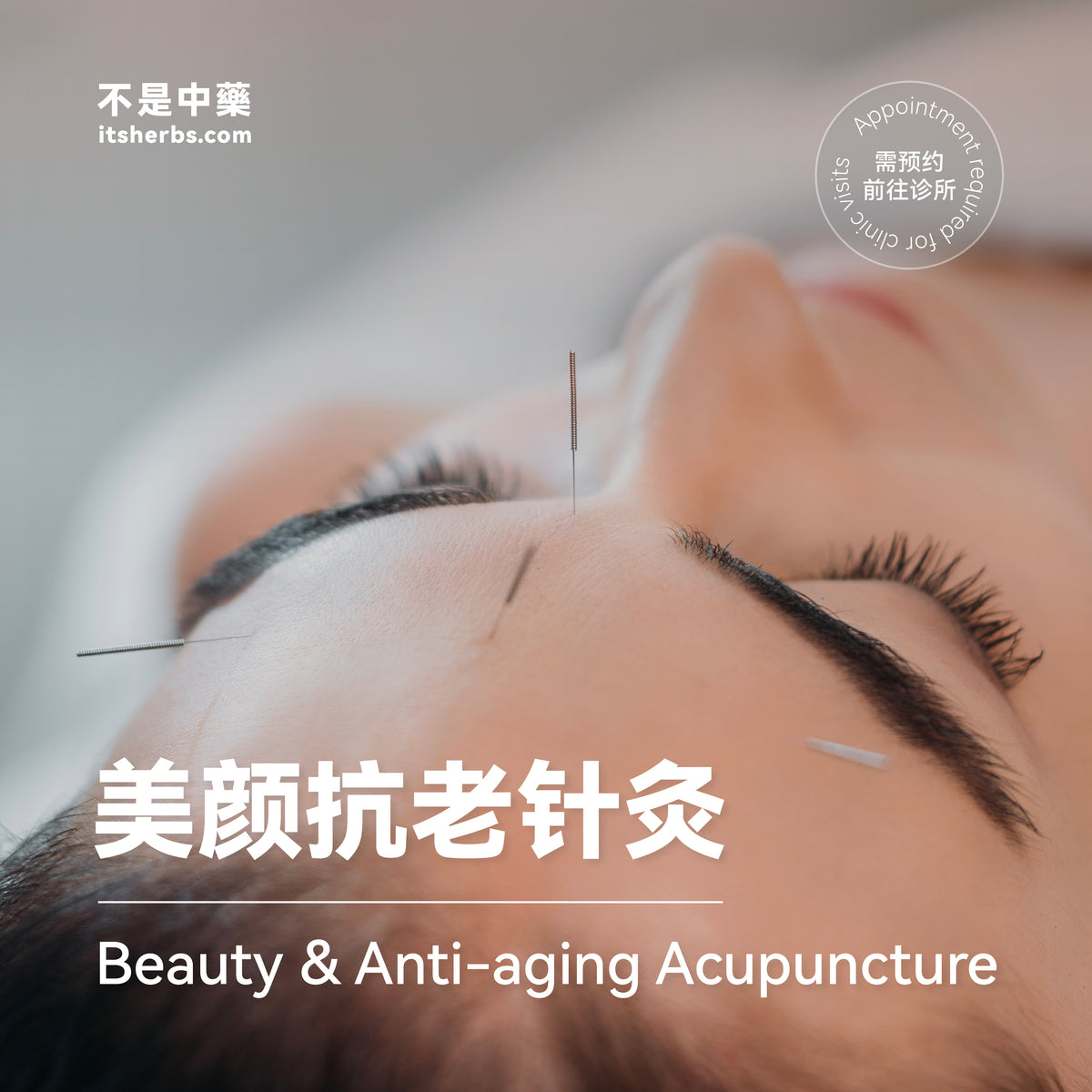 Beauty and Anti-aging Acupuncture Package